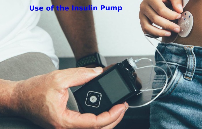 Use of the Insulin Pump