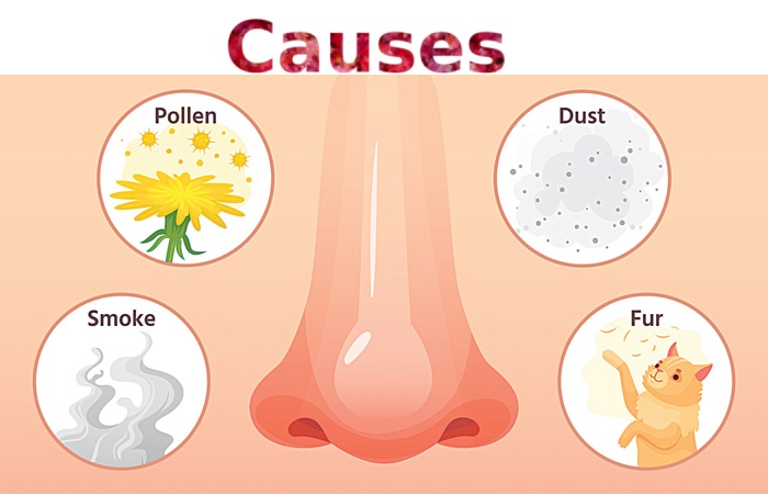 Causes of Allergic Rhinitis