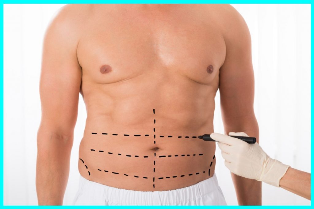 benefits of tummy tuck surgery for men