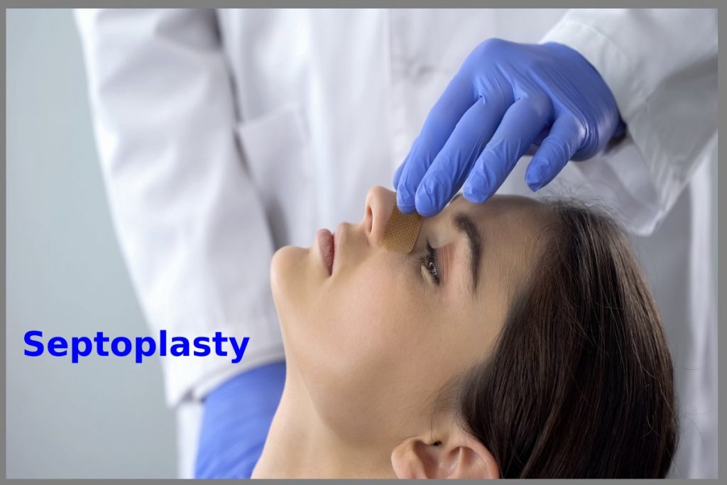 understanding septoplasty and the importance