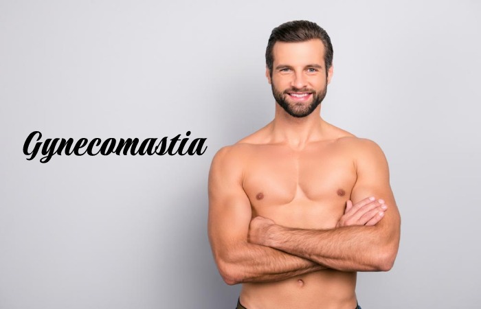 Gynecomastia