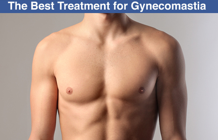 The Best Treatment for Gynecomastia