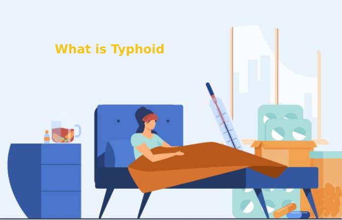What is Typhoid