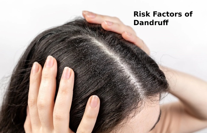 Risk Factors of Dandruff