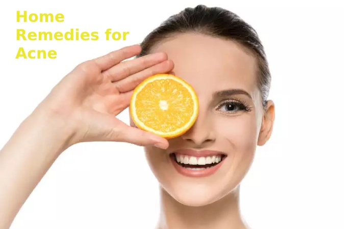 Home Remedies for Acne