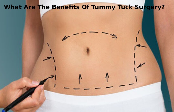 What Are The Benefits Of Tummy Tuck Surgery?