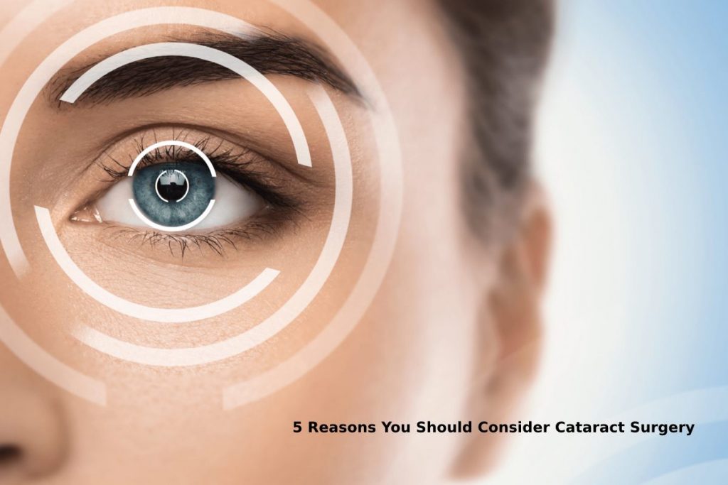 5 Reasons You Should Consider Cataract Surgery