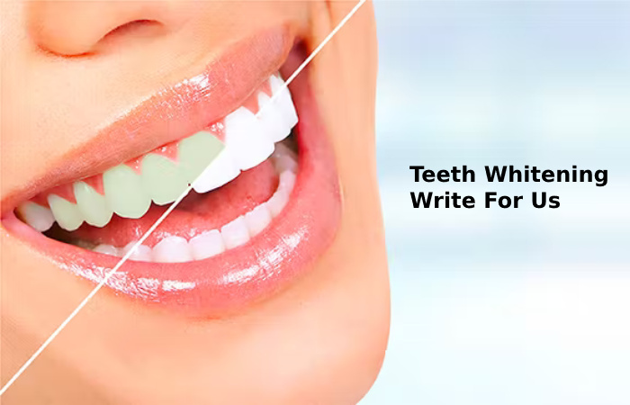 Teeth Whitening Write For Us