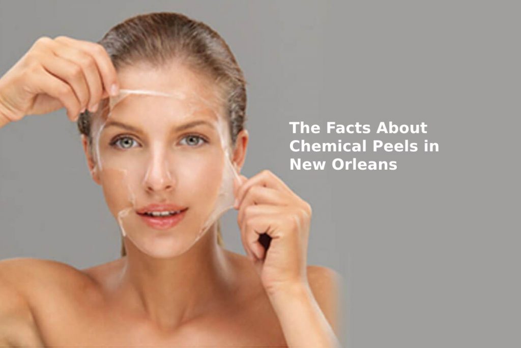The Facts About Chemical Peels in New Orleans