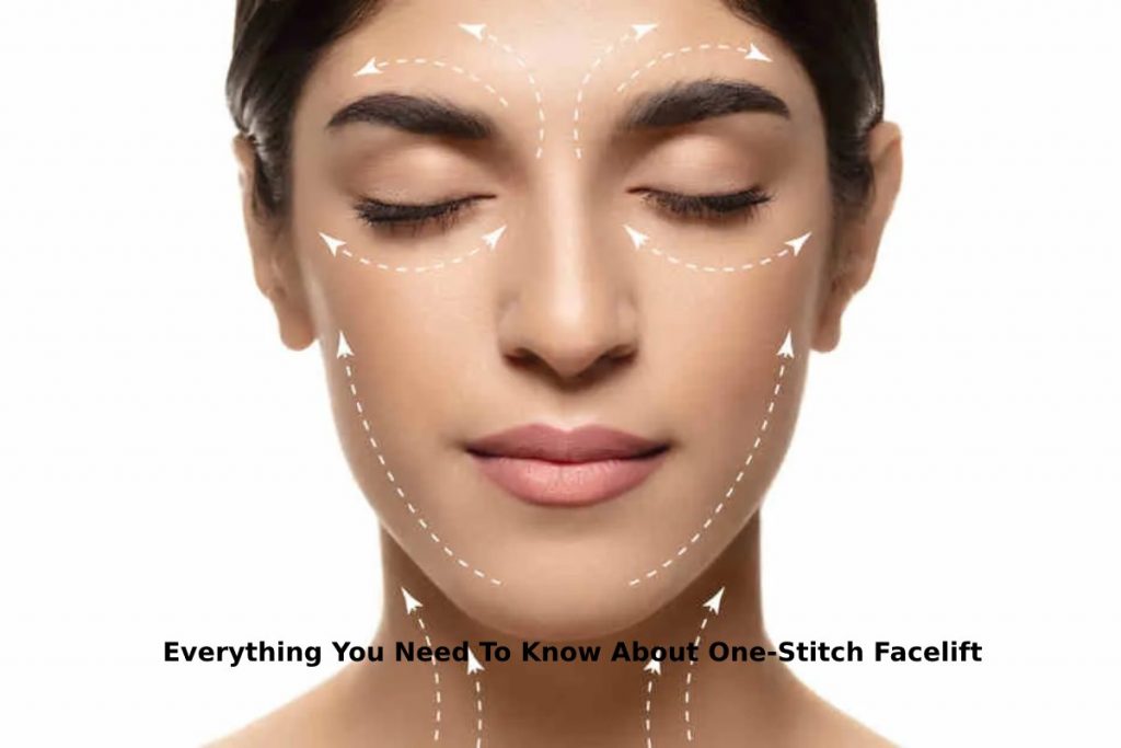 Everything You Need To Know About One-Stitch Facelift