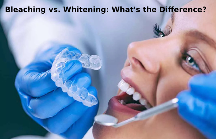 Bleaching vs. Whitening: What's the Difference?