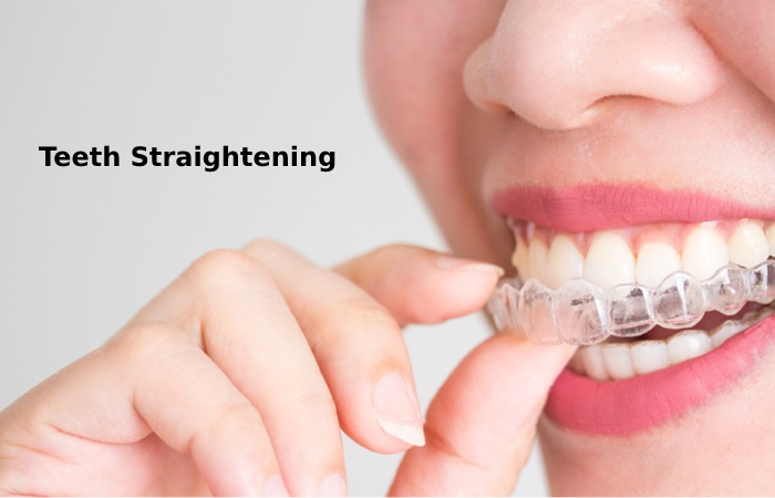 Teeth Straightening