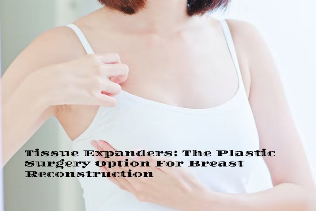 Tissue Expanders: The Plastic Surgery Option For Breast Reconstruction