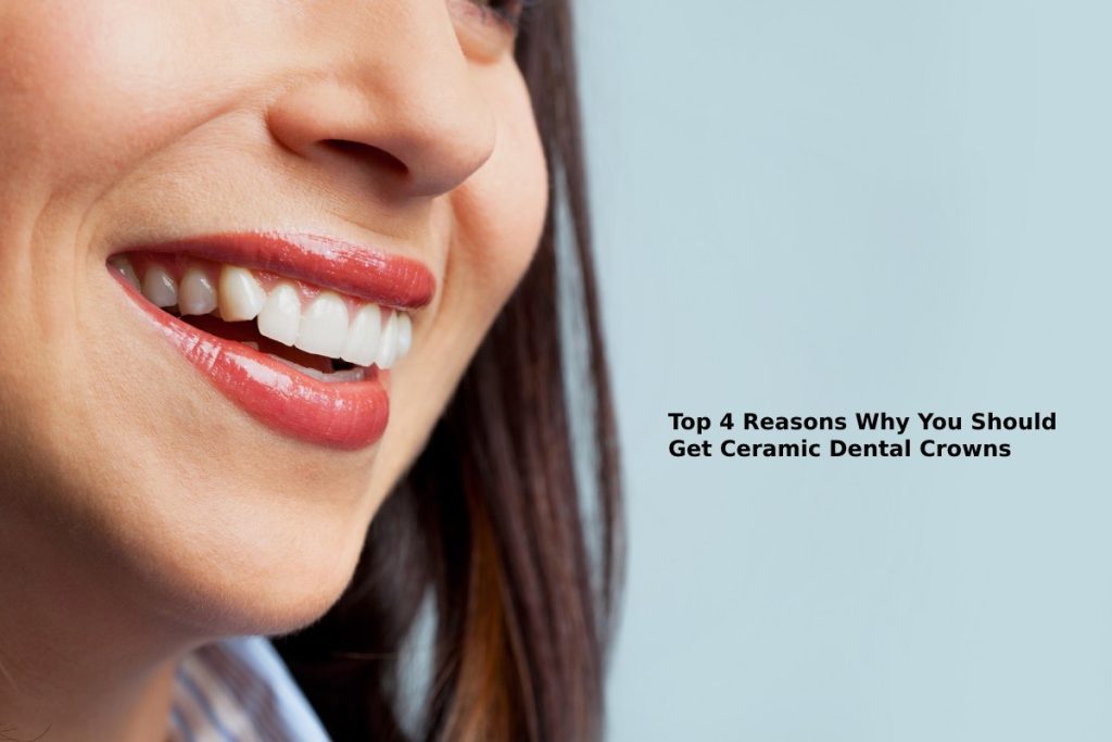 Top 4 Reasons Why You Should Get Ceramic Dental Crowns