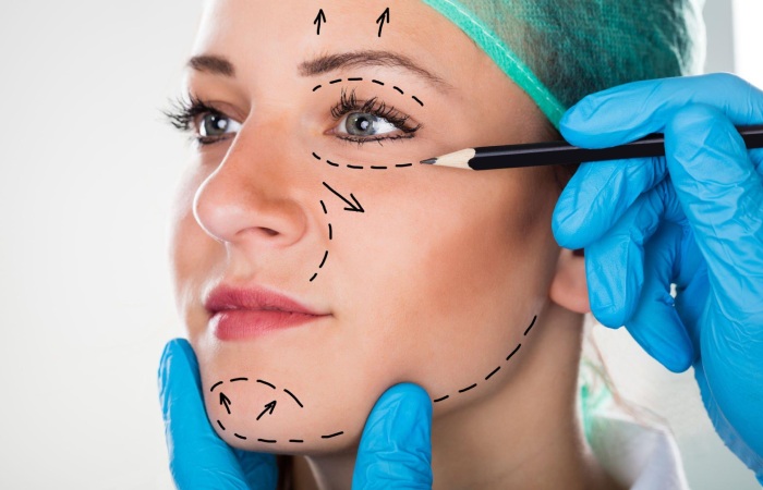 What is the Recovery Time for a Facelift?